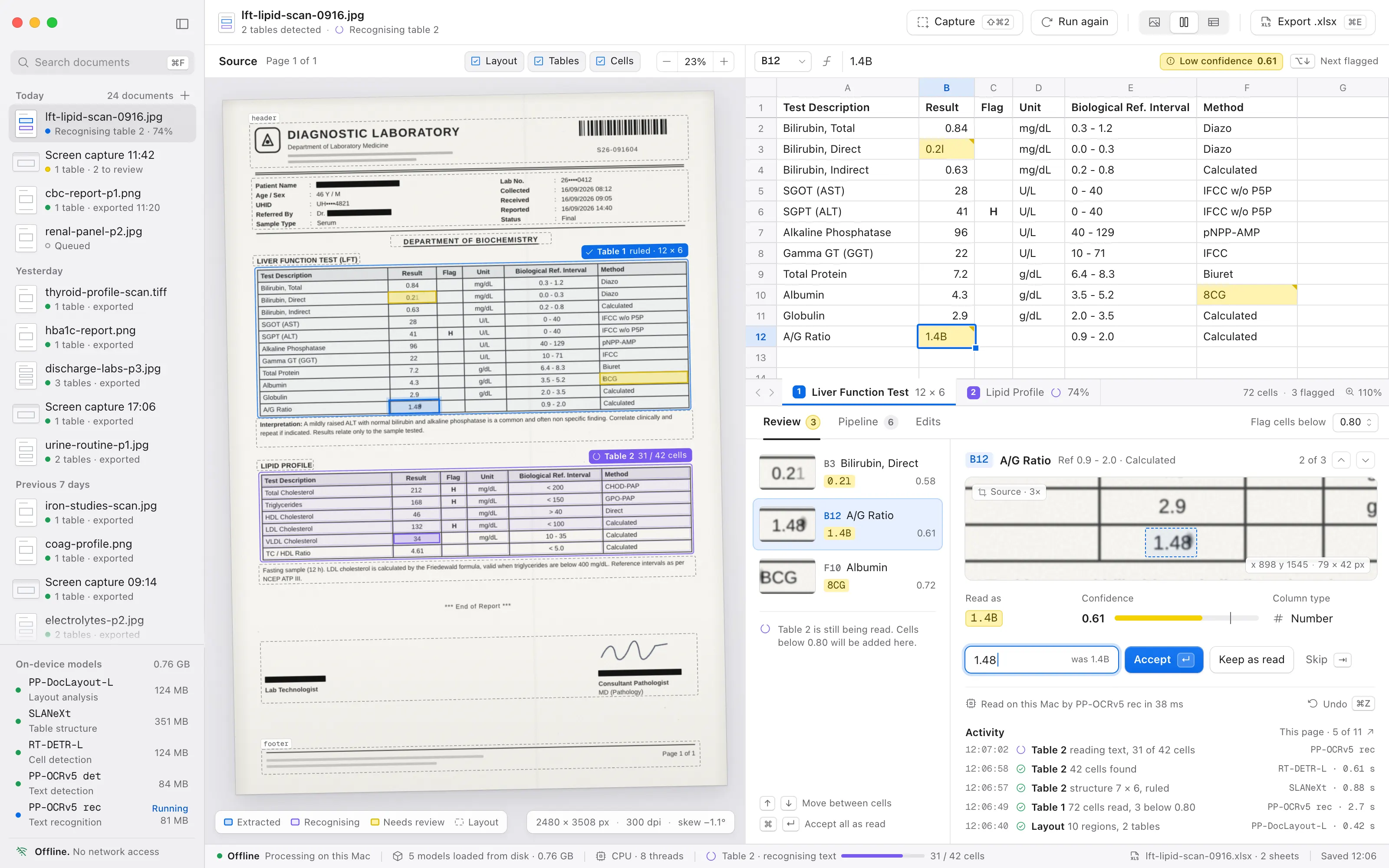 The desktop app mid-extraction: a scanned lab report with its tables detected, the extracted spreadsheet with cells flagged for review, and the local models running offline.